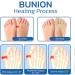 WOSLXM Bunion Relief Toe Socks - Projoint AntiBunions Health Sock with Sockalign Technology (10 Pairs) - Buy Online on GoSupps.com