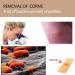 Wart Remover Corn Remover Foot Corn Remover Pads Plantar Wart Removal Corn Callus Remover Penetrates and Removes Common and Plantar Warts Callus Stops Wart Regrowth 20PC - Buy Online on GoSupps.com
