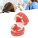 GFRGFH Dental Model Metal Wires 24 Teeth Half Metal Half Ceramic Bracket Tooth Correct Model For Study Teaching