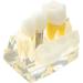 Implant Model Removable Bridge - Educational Teeth Model for Dental Studies | Perfect for Demonstration Classes - Buy Online on GoSupps.com