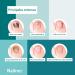 NAILNER L piz Anti-hongos U as 2 en 1 4ML - Buy Online on GoSupps.com