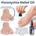 Huile de paronychia allemande pour enlever la paronychia traitement des ongles des pieds meilleure solution de r paration des ongles liquide de renouvellement des ongles endommag s (3 pi ces) 3 pi ces. - Buy Online on GoSupps.com