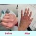 Nursem CARING HAND WASH 300ml | Ultra-Gentle Soap-Free Formula for Very Dry Hands - Buy Online on GoSupps.com