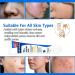 Azelaic Acid Face Serum - Balance Skin Tone Cleanse Pores Reduce Acne Blackhead & Redness Premium Skincare Product 20g(1PCS) 0.7 Fl Oz (Pack of 1) - Buy Online on GoSupps.com