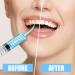 Oral Dental Care Tonsil Stones Removal Feeding Pet 10pcs - Buy Online on GoSupps.com