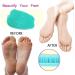 Joebo Foot Scrubber for Shower Non-Slip Suction Cups & Soft Bristles for Improved Blood Circulation - 1 Pack - Buy Online on GoSupps.com