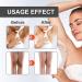 EXQST Jaysuing Snow Bleaching Cream Underarm Snow Whitening Cream (For Private Areas) - Buy Online on GoSupps.com