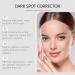 Correcteur de taches brunes Cr me anti-taches brunes Cr me anti-taches de rousseur Att nue les taches solaires les taches de vieillesse et l'hyperpigmentation Restaure l' clat naturel 3pcs - Buy Online on GoSupps.com
