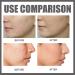 Peptide Serum 20% Collagen Hexapeptide Face Serum Brightening Serum For Women Moisturiser Face Anti Aging Serum For Face Reduce Fine Lines And Wrinkles Collagen Boost Serums Skincare - Buy Online on GoSupps.com