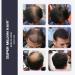 Super Million Hair 15g - No.2 Dark Brown: Instant Hair Loss Concealer - Buy Online on GoSupps.com