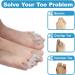 Toe Separators for Bunions & Hammertoes - Adjustable Toe Straighteners Pain Relief & Spacers for Men & Women - 1 Pair (Clear - Buy Online on GoSupps.com