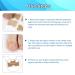 Ingrown Toenail Corrector Patch - Painless Toe Nail Correction Strips (50 Pcs) - Buy Online on GoSupps.com