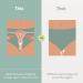 Frida Fertility Conception Aid Cup | Natural Reusable Fertility Support for Women | Soft Silicone Sperm Retention Cup with Storage Bag - Buy Online on GoSupps.com