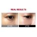 Buy MEDITHERAPY Mega Under Eye Masks - 4 Pairs | Korean Eye Mask for Puffiness Dark Circles & Wrinkles | Best Anti-Wrinkle Skincare Online - Buy Online on GoSupps.com