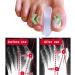 Reppkyh Gel Toe Separator Set - Bunion Corrector & Relief Spacers for Overlapping & Hammer Toes - Buy Online on GoSupps.com