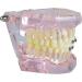 Buy Dental Teeth Model Demo | Transparent Implant & Orthodontic Retainer | International Shipping - Buy Online on GoSupps.com