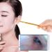 Ear Wax Removal 3-in-1 Earwax Removal Kit Ear Wax Remove Ear Pick Ear Cleaning Endoscope 1.0 Pixel HD Visual Ear Spoon Multifunctional Ear Inspection Endoscope Earpick Ear Cleaner