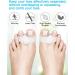Golbylicc Bunion Corrector Toe Separators - 8 Pairs for Women Men - Gel Toe Spacers with 2 Loops - White - Buy Online on GoSupps.com
