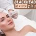 OCBA Blackhead Remover Tool | Professional Skincare Spot Treatment for Blemish, Comedone, Whiteheads, Pimple | Double Sided Soft Touch | Anti-Slip Design - Buy Online on GoSupps.com