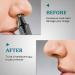 KouRy Nose Hair Trimmer Professional Waterproof Ear & Nose Hair Trimmer for Men & Women | 3-in-1 Dual Edge Blades for Easy Cleaning - Buy Online on GoSupps.com