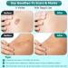 Advanced Scar Gel for Surgical Acne & Keloid Scars - Effective Scar Removal for Face & Body - 100% New - 2 Bottles - Buy Online on GoSupps.com