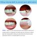 False Tooth Repair Kit with Thermal Fitting Beads - Snap On Instant Smile - Denture Adhesive - Buy Online on GoSupps.com