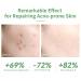 Buy 10% Salicylic Acid Serum - Acne Treatment Minimize Pores & Redness Relief for Sensitive Skin - 30ml - Buy Online on GoSupps.com