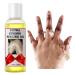 Peeling Oil Yellow Peeling Oil for Dark Skin Peeling Oil Extra Strength Yellow Peeling Oil Extra Strong Skin Peeling Strong Peeling Oil Peeling Solution Body Peeling Oil 110ML/3.66 OZ 110 ml (Pack of 1) Yellow