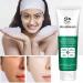  Miake Face Wash for Women Whiten Cleanser for Glowing Skin 120g Makeup Remover and Facial Cleanser Brightens and Refreshes Your Skin for Combination and Oily Skin Miake - Buy Online on GoSupps.com