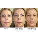 RejuveMD Growth Factor Anti-Aging Eye Serum - 0.5 Fl oz - Buy Online on GoSupps.com