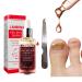 Beito 1PC Nail Repairs Solution de renouvellement des ongles l'huile essentielle tue les ongles fongiques Traitement fongique pour ongles cassants et craquel s (12ML)