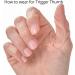 Oval-8 Finger Splint Graduated Set - Sizes 8, 9, 10 (3 Piece Assortment) - Buy Online on GoSupps.com