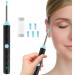 1296P HD WiFi Ear Wax Remover Kit with Camera - Waterproof Wireless Visual Ear Cleaner - Buy Online on GoSupps.com