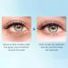 Aloe Vera Eye Cream - Anti-Aging Moisturizing Eye Care for Dark Circles & Wrinkles | Hydrating 20g (5 Pieces) - Buy Online on GoSupps.com
