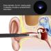 Earwax Removal Kit with Camera | Home Ear Cleaning Tool - Buy Online on GoSupps.com