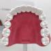 Upikit Dental Model for Sick Teeth - Compare Smoking vs Normal Teeth | Ideal for Medical Demonstrations - Buy Online on GoSupps.com