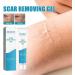 WWDZ Scar Removal Cream Gel - 2pcs Set for Repairing Pock Marks, Burns, Surgical Scars, and Cesarean Scars - Stretch Mark Treatment and Skin Moisturizer - Buy Online on GoSupps.com