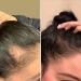  Rossen Rossen Hair Infusion Set Hair Loss Treatment Promotes Growth with Argan Oil and Ginger 4 in 1 Formula with Natural Ingredients Strengthens and Nourishes - Buy Online on GoSupps.com