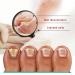 Kerassentials Toenail Treatment Oil - Supports Strong & Healthy Nails - 3PCS - Buy Online on GoSupps.com