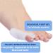 Feifanshop Silicone Gel Toe Spreader - Bunionette & Pain Relief Toe Separator for Comfort & Relaxation | International Shipping - Buy Online on GoSupps.com