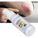 Travel-size Itching Relief Spray 30ml - Natural Skin Immunity Support - Buy Online on GoSupps.com