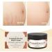 Stretch Mark Cream Pregnancy Belly | 50g Postpartum Abdomen Care | Nourishing Moisturizer Skin Care Maternity | For Pregnant Women and After Childbirth - Buy Online on GoSupps.com