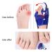 Bunion Corrector Toe Separator for Painless Hallux Valgus Correction - Buy Online on GoSupps.com