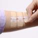 Longmed Emergency Wound Closures - Butterfly Adhesive Bandages - 3 Pieces - Buy Online on GoSupps.com