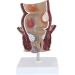 Rectal Pathology Model hemorrhoid Model proctology retal Disease Demonstration 5X Anal Anal and Anal Canal Model Anal and anorect Rectal 11 * 11 * 18.5cm - Buy Online on GoSupps.com