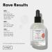 Buy dpHUE ACV Daily Scalp Serum - Soothe Dry Scalps & Promote Healthy Hair Growth - 1.7 fl oz - Hyaluronic Acid Formula - International Shipping Available - Buy Online on GoSupps.com