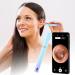 Wireless Visual Otoscope Visual Luminous Ear Pick Ear Cleaning Tool Luminous HD Endoscopy Ear Picking Spoon Ear Wax Cleaning
