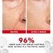 6 Peptide Se rum for Fa ce | 50ml | Complex Collagen Boosting Firming Essence for Fa ce Niacinamide & Hyaluronic Fa ce Se rum Reduce Fine Lines Wrinkles Fa ce Se rum for Men & Women - Buy Online on GoSupps.com