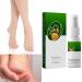 Herbal Foot Spray for Athlete's Feet and Odor Removal | Peeling Foot Care Formula | Eliminates Foot Odor in Shoes & Sports Equipment | 30ml CxC096 - Buy Online on GoSupps.com