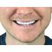 Instant Smile Flex 2pk - Bright White Shade - One Size Fits Most - Easy At-Home Fix for a Perfect Smile! - Buy Online on GoSupps.com